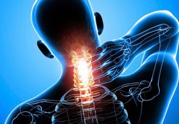 s cervikalnom osteohondrozom moguća je bol u zglobovima zajednički uklanjanje boli