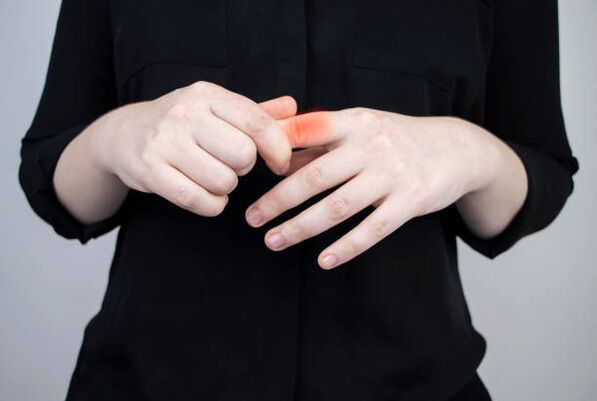 liječenje artroze prsta lijekovima