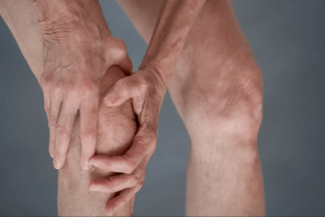 bolovi u zglobovima mogu biti uzrok artroze ili artritisa