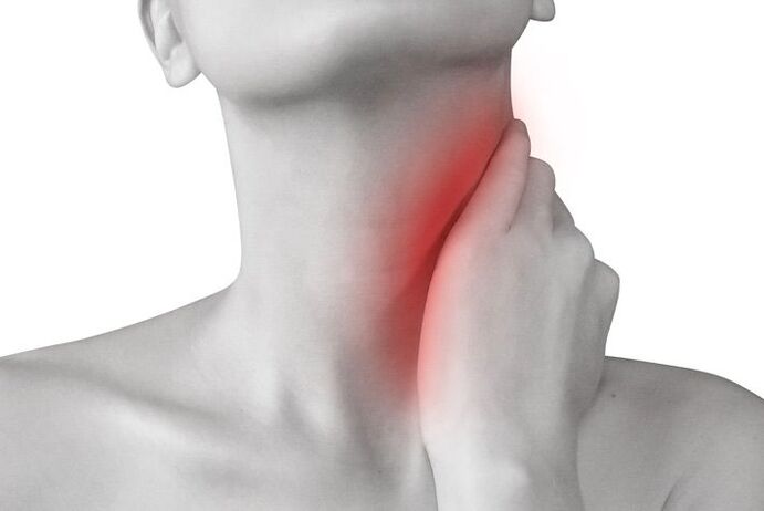 upala limfnih čvorova kao uzrok boli u vratu