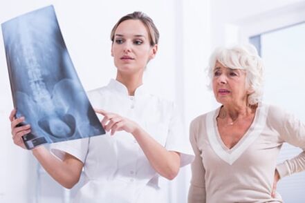 Rentgenski pregled je informativan način dijagnosticiranja osteohondroze kralježnice