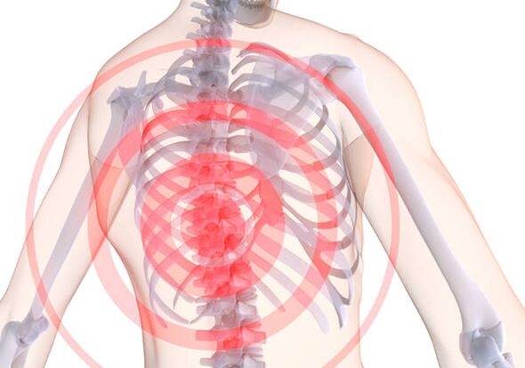 Torakalnu osteohondrozu prati dorsago - akutna bol koja sputava mišiće