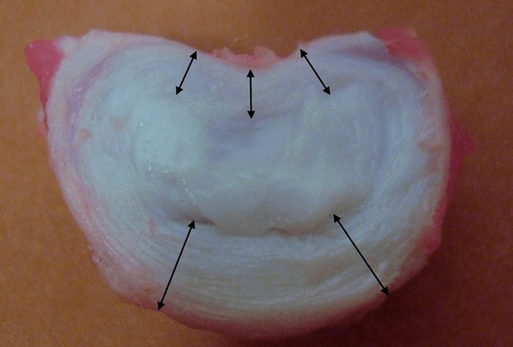 kako izgleda intervertebralni disk