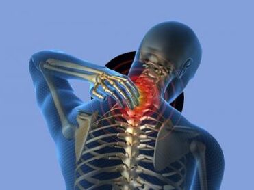 Osobu s osteohondrozom vratne kralježnice muči bol u vratu
